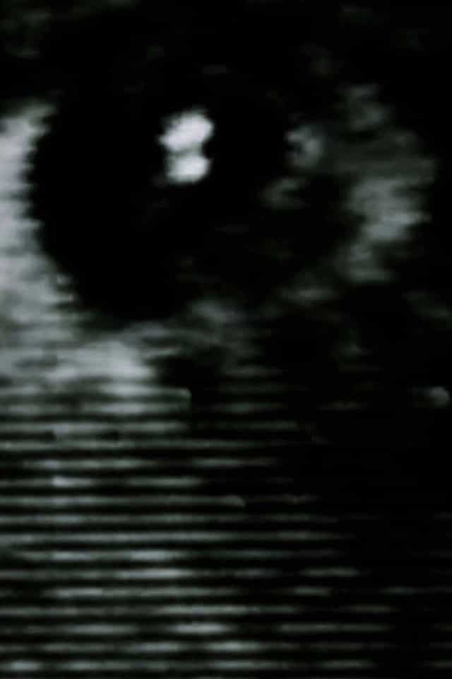 1012406