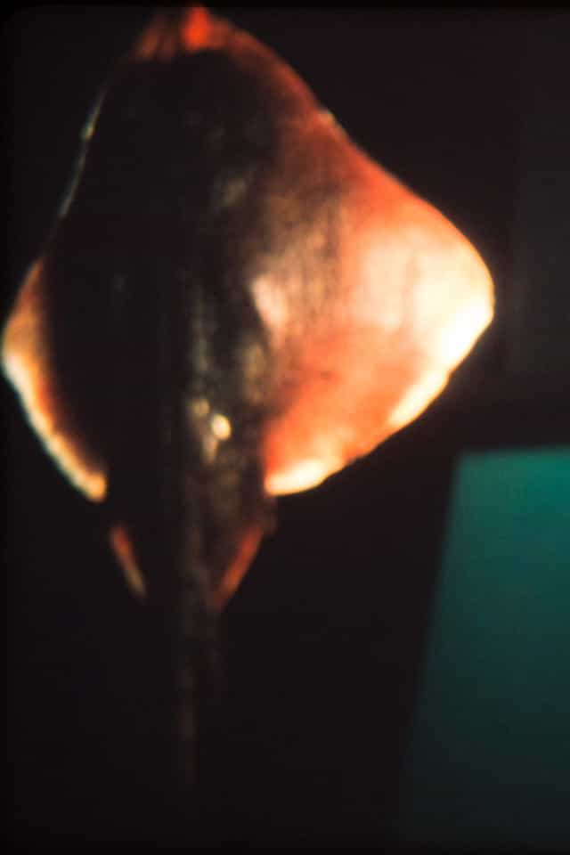 1010114